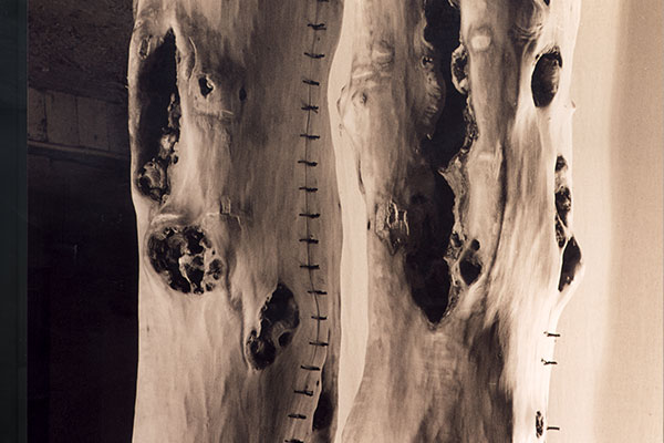 Zwei Körper mit Wunden, verletzt und vernarbt